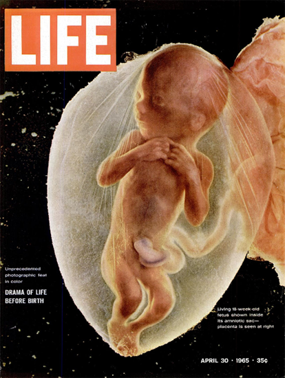 Drama of Life before Birth 30 Apr 1965 Copyright Life Magazine | Life Magazine Color Photo Covers 1937-1970